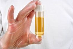 Urinalysis is one of the methods to diagnose prostatitis