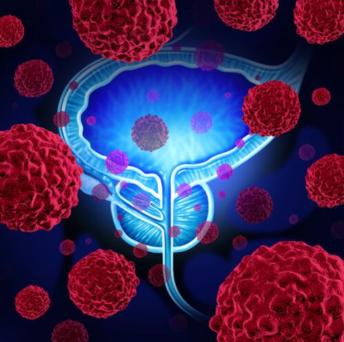 The activity of pathogenic microorganisms is the cause of prostatitis